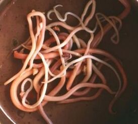Intestinal parasites