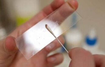 Which tests should be carried out for parasites
