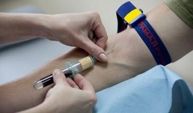 how to prepare for the test of parasites