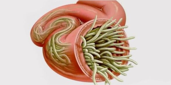 Parasites in the human intestine